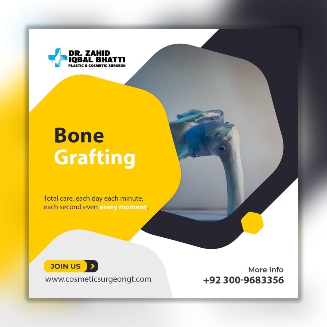 Bone Grafting Banner Design