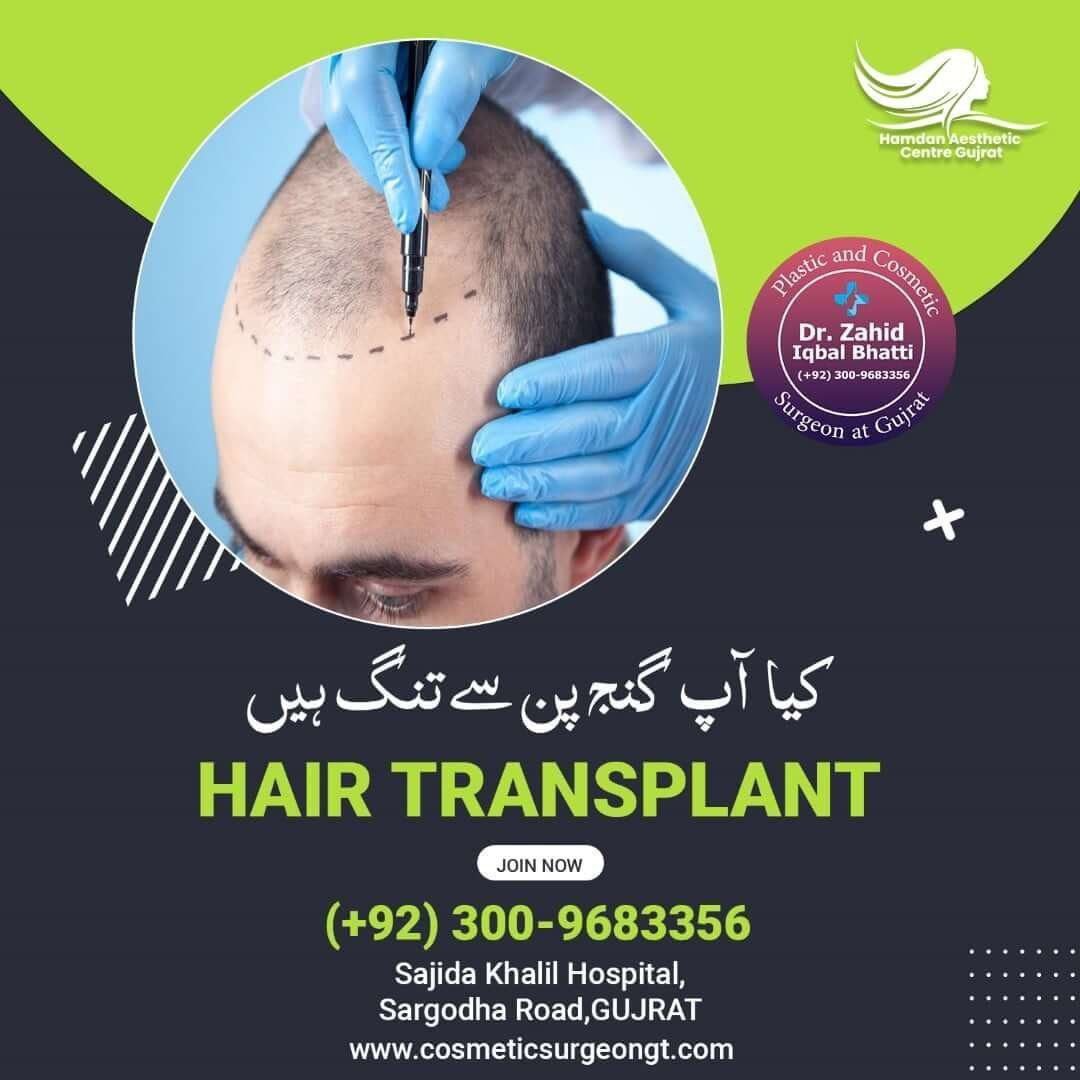 Hair Transplant Social Media Banner Design