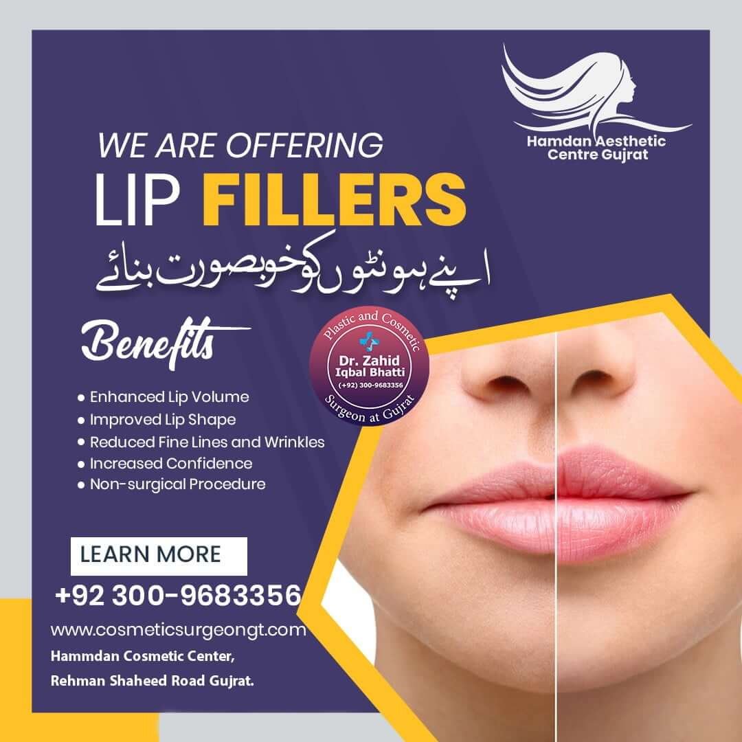 Lip Fillers Social Media Banner