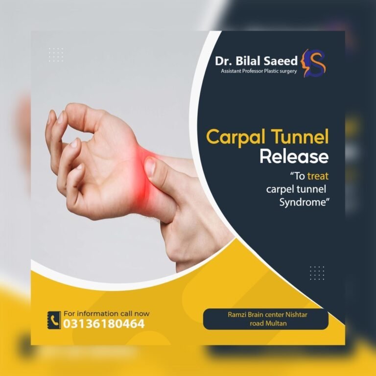 Carpal Tunnel Release