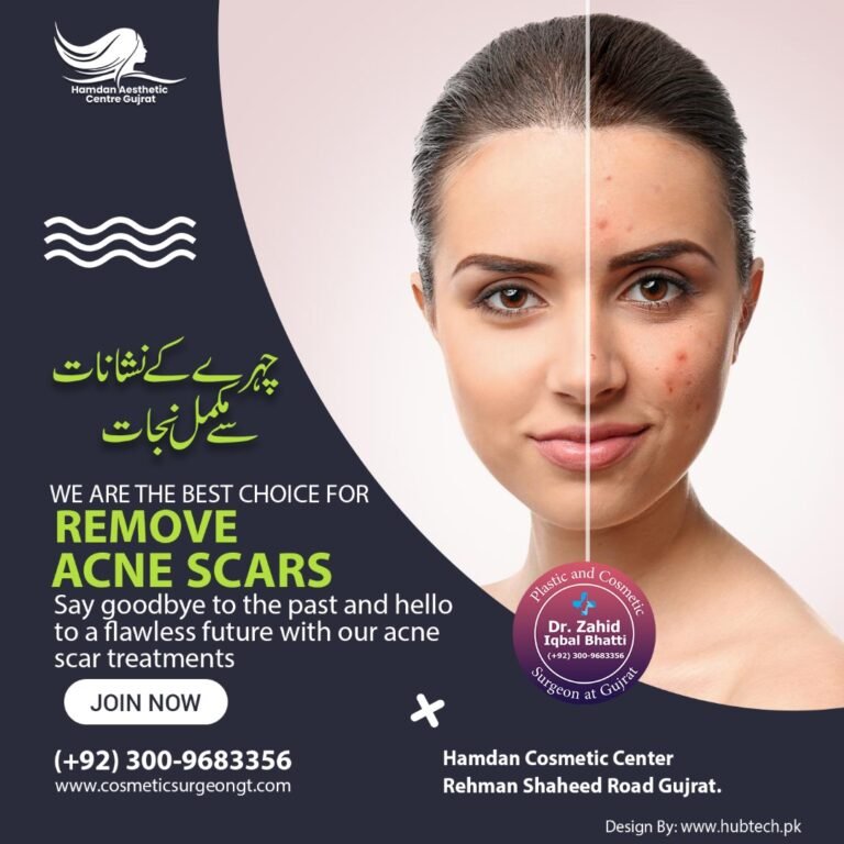 Acne Scar Removal