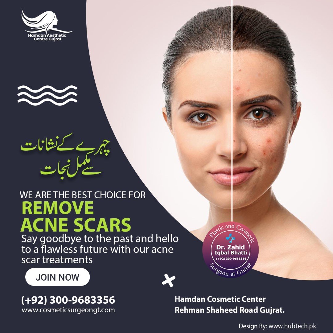 Acne Scar Removal